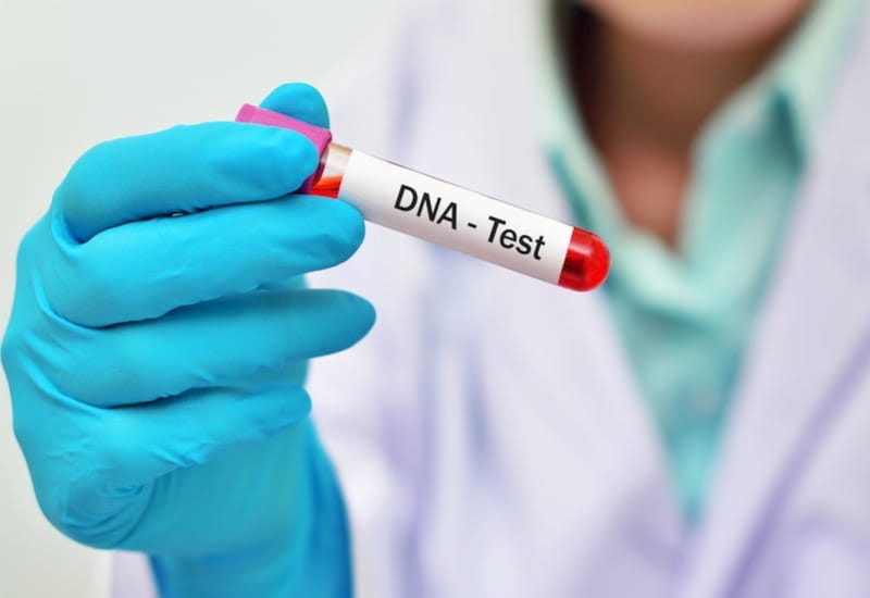ét Nghiệm DNA Trong Hồ Sơ CRBA